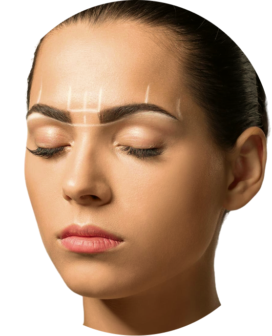 Brow lift