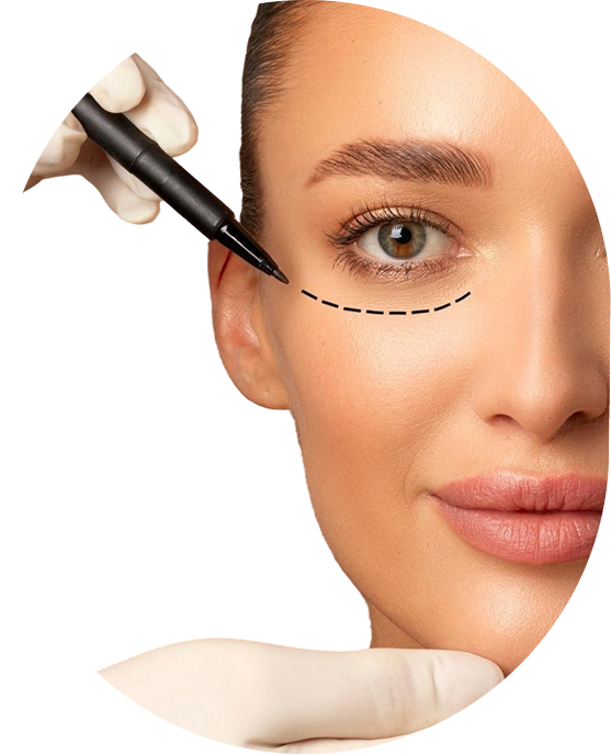 Eyelid surgery